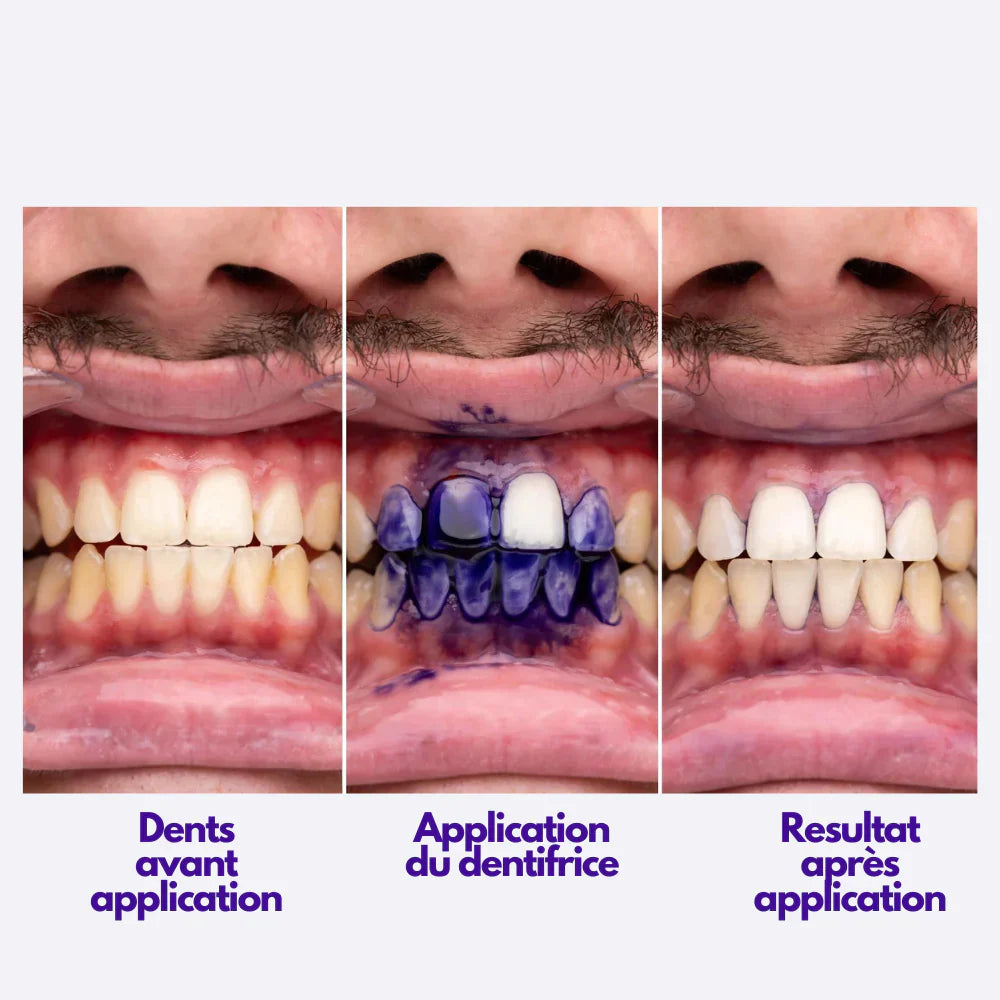 Dentifrice Blanchissant V34