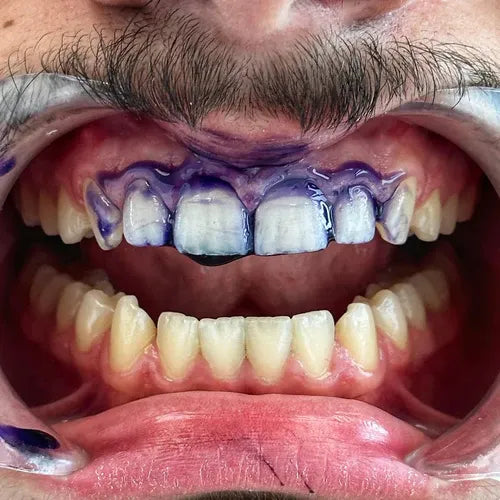 Dentifrice Blanchissant V34