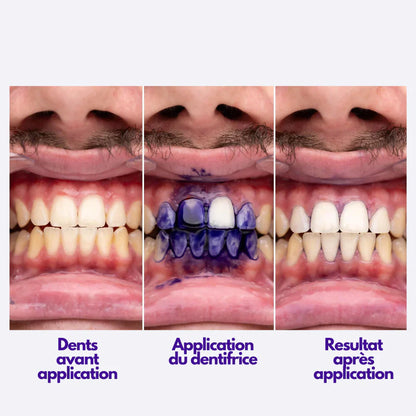 Dentifrice Blanchissant V34